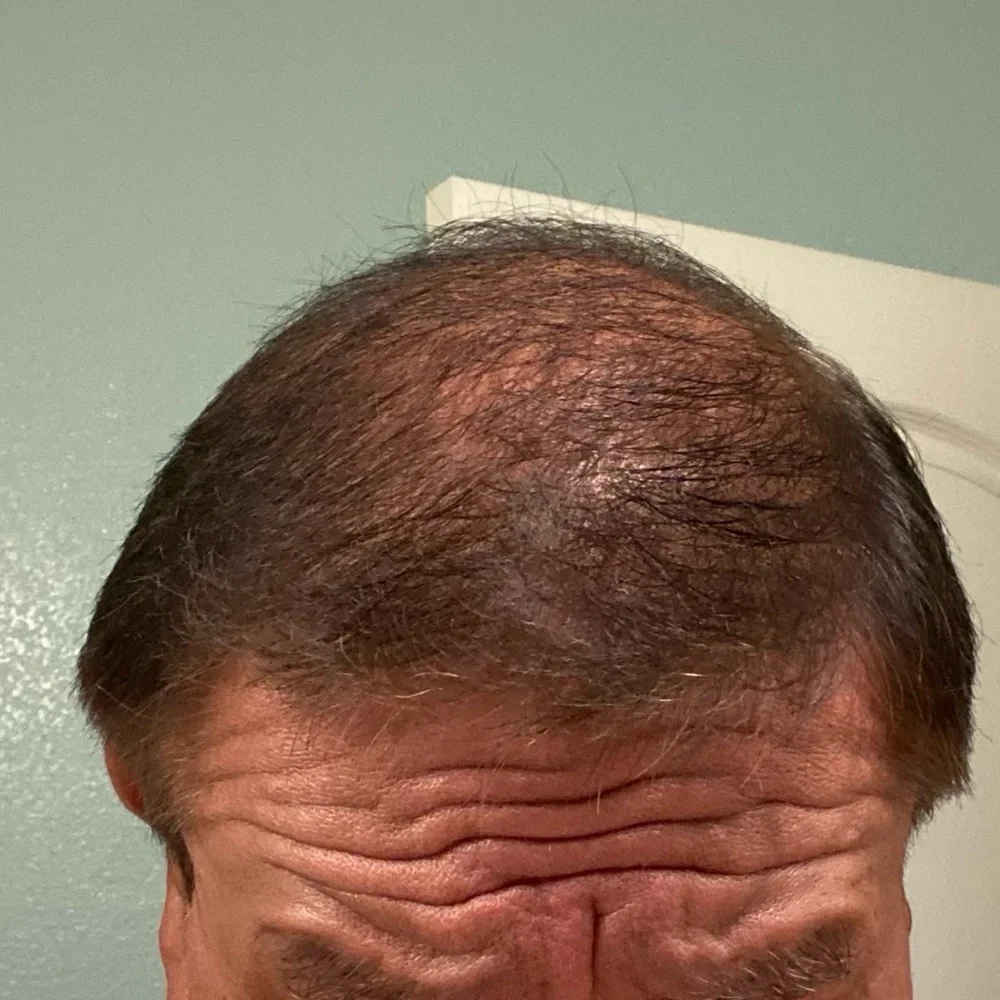Arzola’s‎ shampoo for hair growth